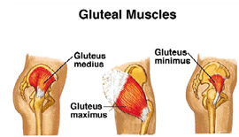 35 Ideas Can you walk with a torn gluteus medius 