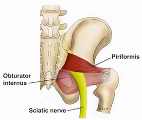 Piriformis Syndrome  Florida Orthopaedic Institute